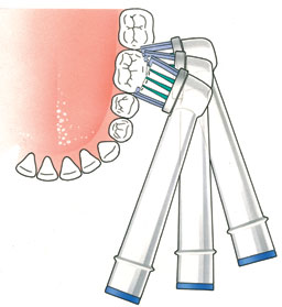 Onderdrukking Hijsen Handschrift Elektrische tandenborstel – Tandartspraktijk van de Vondervoort – Eindhoven